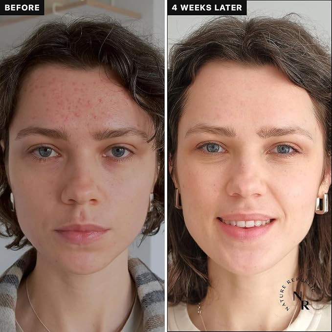 Nature Republic Vitapair C Glow Facial Toner - Vitamin Toners for Face, Hydrating Skin Care for Women, Niacinamide Korean Skincare, Clean Clear Moisturizing, Gentle Natural Beauty, 300ml / 10.15 fl oz