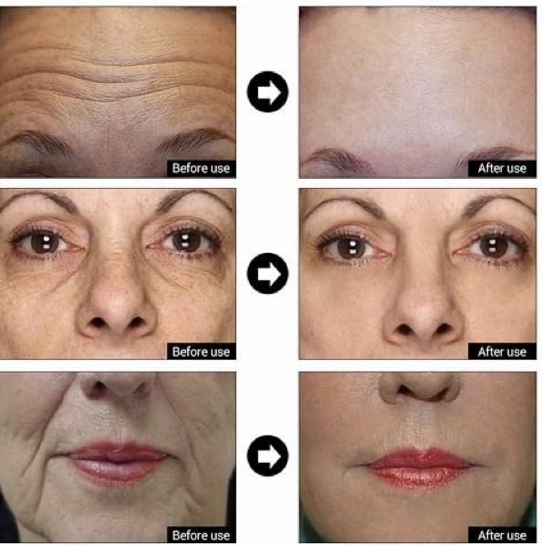 Matrixyl 3000 + Argireline, Vitamin C, Hyaluronic Acid Serum, Anti-Aging Face Serum, Anti-Wrinkle Serum for face, Multi Peptide Firming Serum - 8oz