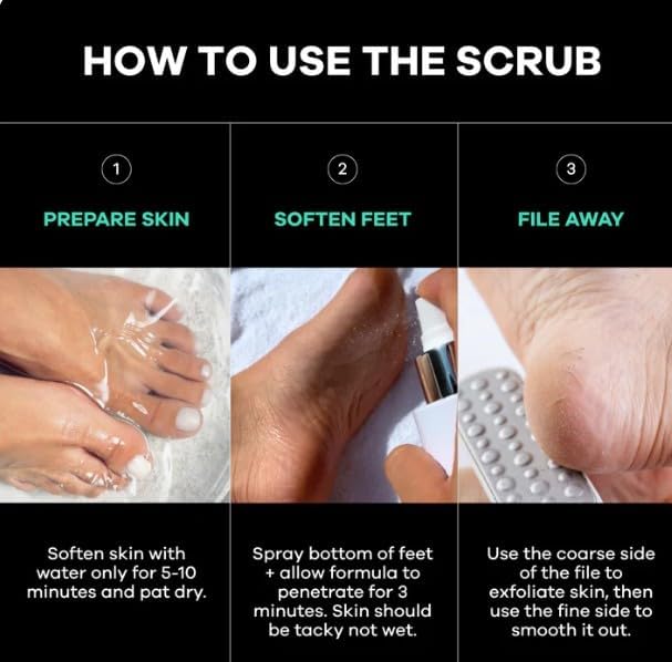 Dermasuri Callus Remover Foot Scrub - Exfoliating Feet Spray-on Formula and Reusable Deluxe Sole File - Dead Skin Remover, Callus Rasp, Scrubber, Peel & Soften Cracked Heels - Deluxe Pedicure Spa Kit