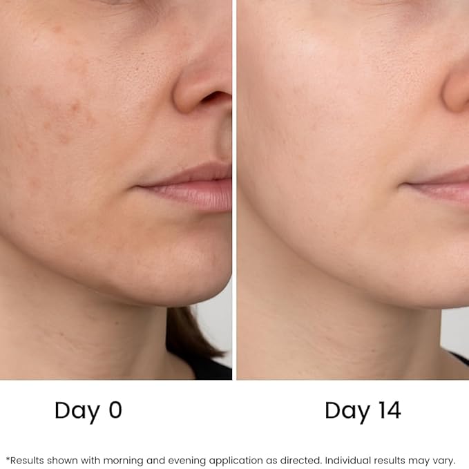 All Natural Pure 20% Vitamin C Serum For Face + 6 Active Boosters for Dark Spots, Wrinkles, Brightening, Hydrating, Even Tone, Healthy Glow with Niacinamide, Hyaluronic Acid, Ferulic Acid, Vitamin E