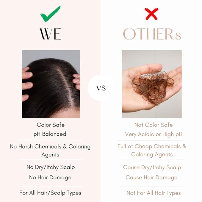 K C Scalp Detox & Hair Treatment Mask - Deep Conditioner for Dry Scalp & Damaged Hair – Scalp Care for Buildup, Flakes & Oil Control – All Hair/Scalp Types – Spa Grade Formula (WOMEN)