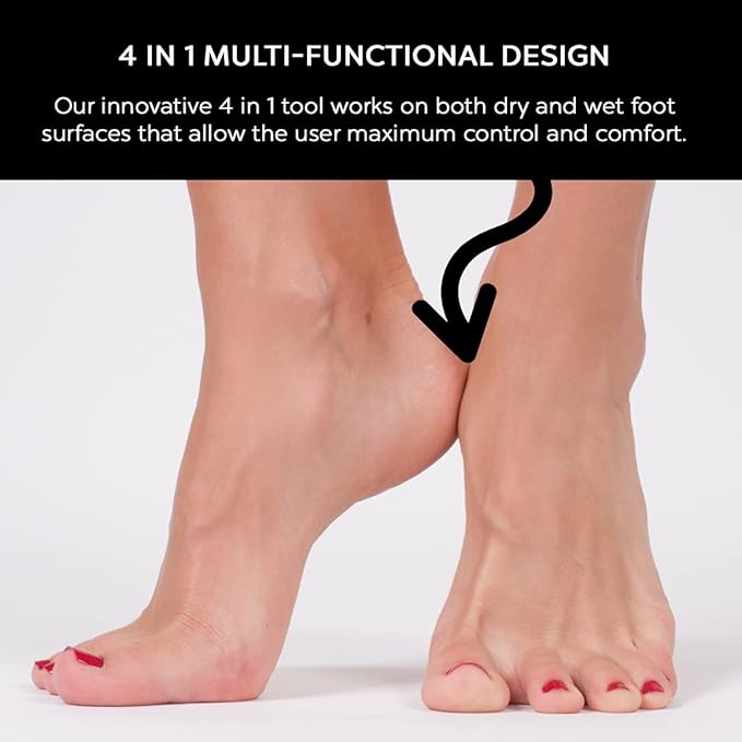 4 in 1 The Pedi Care Stick 4 Sided Pedicure Paddle Metal File and Emery Board Tool with Pumice Stone for Feet by DreamCut
