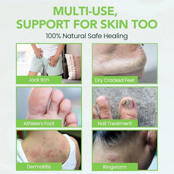 THENA Athletes Foot Treatment Balm, Extra Strength Power6 Formula Foot Cream with Tea Tree Peppermint Neem, Repairs Dry Cracked Feet Heels Itchy Skin Nails Toenails, Advanced Foot Care for Men Women