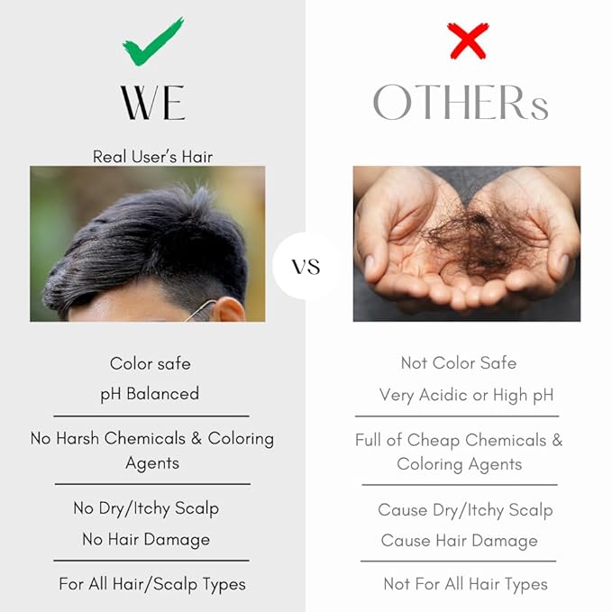 K C Scalp Detox & Hair Treatment Mask - Deep Conditioner for Dry Scalp & Damaged Hair – Scalp Care for Buildup, Flakes & Oil Control – All Hair/Scalp Types – Spa Grade Formula (MEN)