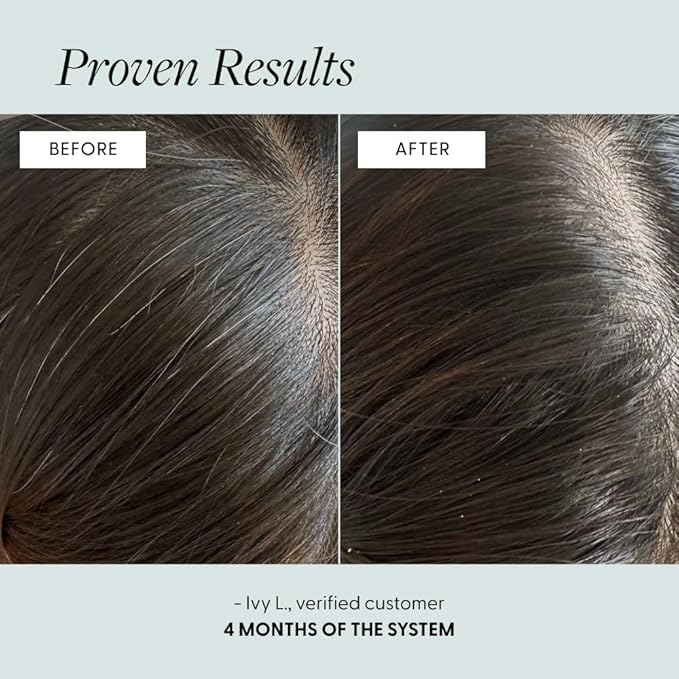Arey The System Daily Hair Serum and Supplement Treatment for Women & Men | Slows Grey Hair Growth in 3-6 Months | Promote Thicker, Fuller Regrowth | Biotin, B + D Vitamins (1 Month Supply)