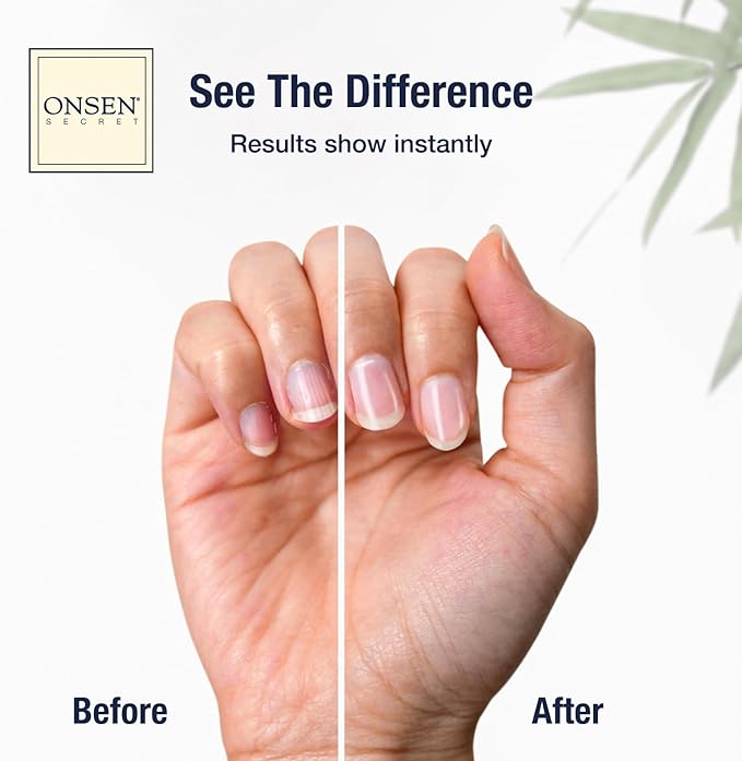 Onsen Secret Ultimate Nail Reboot Kit - Professional Nail File and Buffer, 3-Way Block w/Replacement Pads, Nail Strengthening Cuticle Cream, Reboot Oil & Anti Aging Hand Lotion
