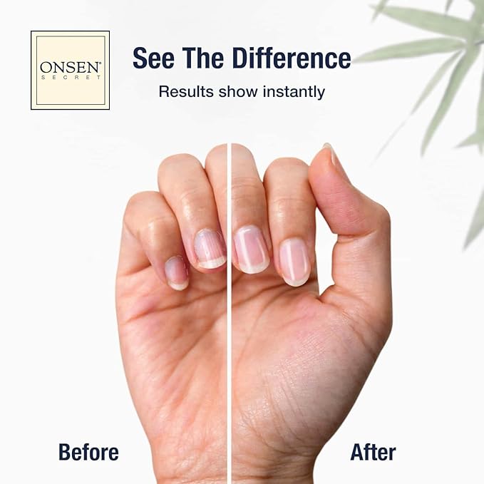 Onsen Secret Nail Care Kit - Japanese Nail Buffer and Shine Kit - Strengthening & Shining - Spa-Quality Manicure - Organic Ingredients - Long-Lasting Shine - Easy & Safe - w/Cuticle Care Serum - 1pk