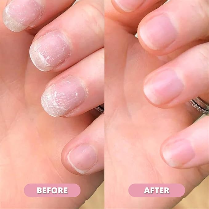 Radiant Nail 𝐆𝐫𝐨𝐰𝐭𝐡 Oil Pen, Cuticle Oil for Nails, Nail 𝐍𝐮𝐭𝐫𝐢𝐞𝐧𝐭 Oil Pen for Moisturize Strengthen 𝐁𝐫𝐢𝐠𝐡𝐭𝐞𝐧 Nails Care (2pcs, 2ml)