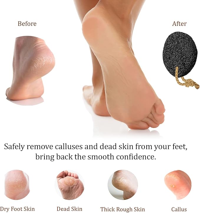 Pumice Stone - Natural Earth Lava Black - Callus/Corn Remover for Feet Heels and Palm - Pedicure Exfoliation Tool - Dry Dead Skin Scrubber - Health Foot Care