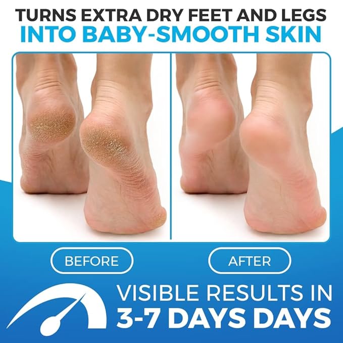 Imperial Feet Foot Balm Soft - Cream for Dry Skin - for Dry feet - Soft and Smooth Feet - Honey - 150ML