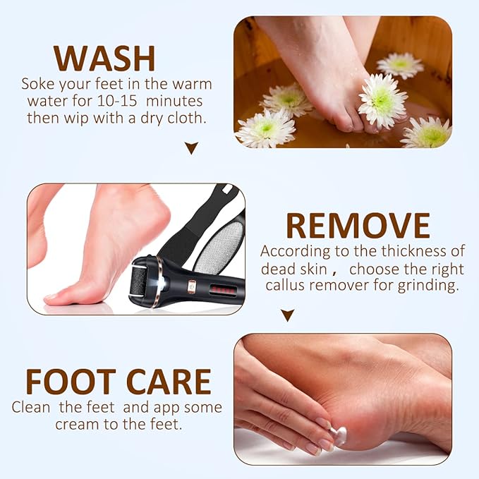 Electric Callus Remover for Feet,Rechargeable Foot File Hard Skin Remover,Waterproof 14 in1 Professional Pedicure Kit for Cracked Heels &Dead Skin,with 3 Roller Heads 2 Speed