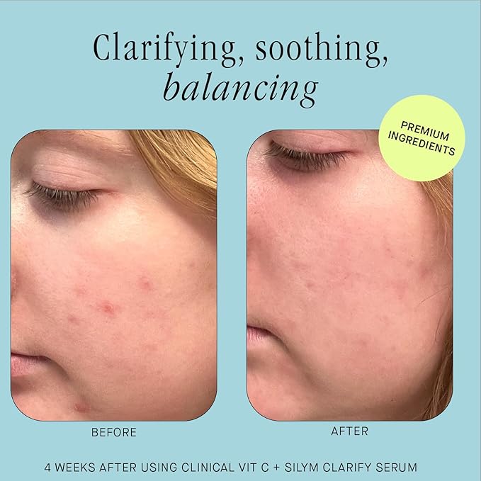 Brandefy Vitamin C + Silym Clarify Serum - Face Salicylic Acid Serum for Blemish-Prone Skin, Promotes Clear Complexion, Anti-Aging, Brightening, Made in The USA (1 oz)