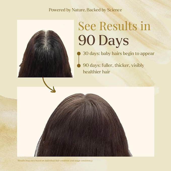 D'Cherlane Goodness Hair Oil – Hair Growth & Deep Scalp Treatment with Rosemary, Argan, Castor, & Coconut Oils For All Hair Types - Verde Harmony Edition (3.4 Fl Oz (Pack of 1))