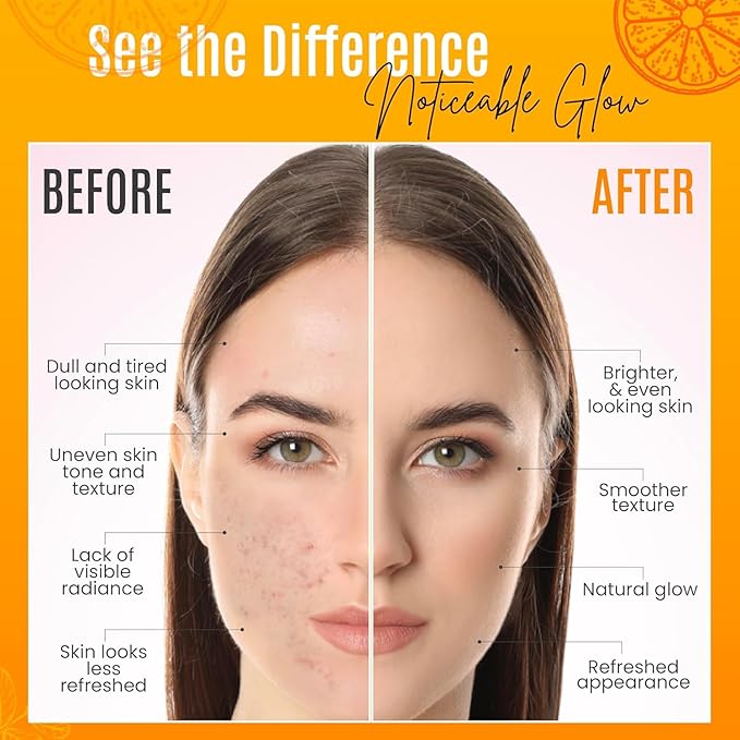 30% Vitamin C Serum for Face - Natural & Organic Anti Wrinkle & Skin Rejuvenator Moisturizer with Hyaluronic Acid & Vitamin E - Powerful Anti Aging Serum - Age-Defying Beauty Regimen- 4 FL OZ