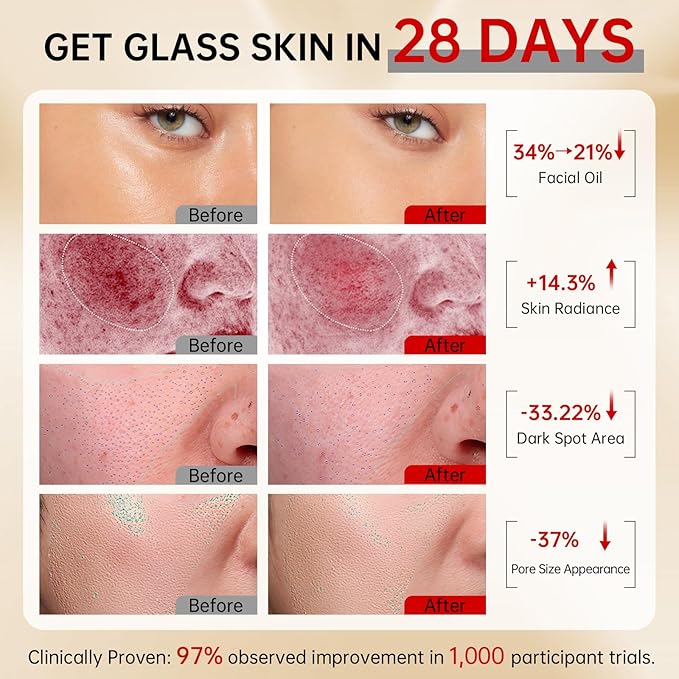 VGO Skin Care Set, with Snail Mucin 92% Moisturizer 1.76 Oz, Vitamin C Serum 1.01 Oz & Dual-Tube Facial Cleanser 3.52 Oz, Daily Routine Kit for Sensitive Skin, Vegan & Cruelty Free