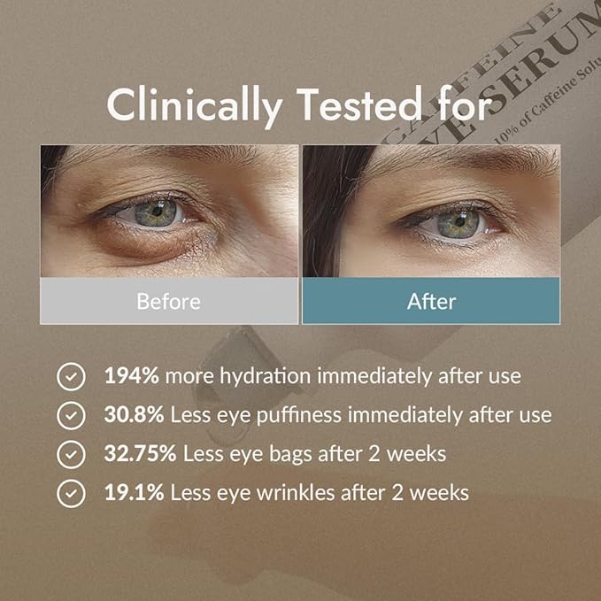 VILLAGE11FACTORY Hydro Boost Caffeine Eye Serum (0.33 fl.oz./10ml) With 10% Caffeine Solution Niacinamide & Hexapeptide-8 Depuff Elasticity Dark Circle Treatment