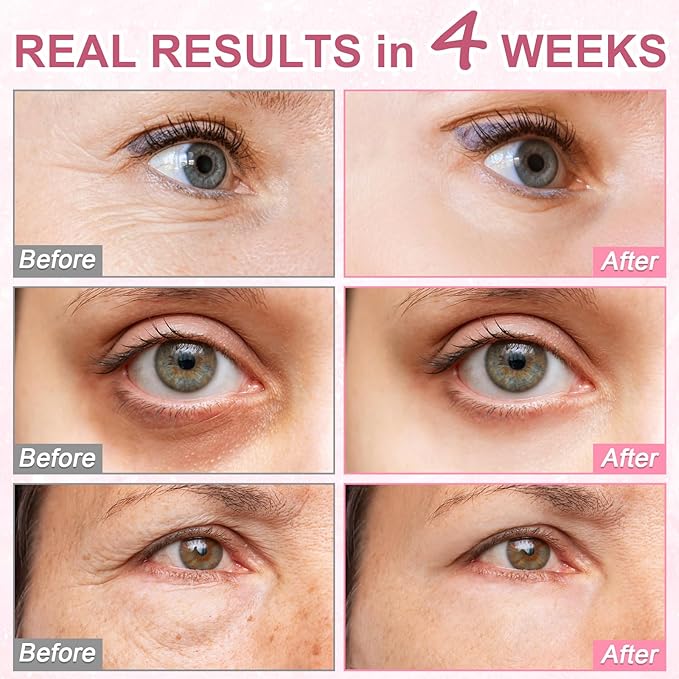 5% Caffeine Eye Serum Treatment,Hyaluronic Acid & Niacinamide, Under Eye Cream for Dark Circles, Anti Aging 360° Massage Rollerball - Reduce Puffiness, Wrinkles & Fine Lines, 0.5 fl. oz