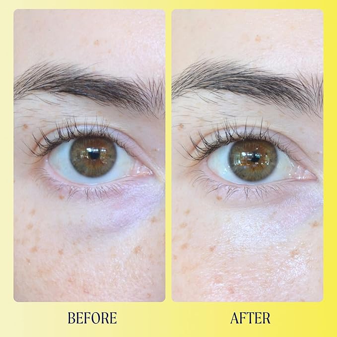 Kinship Brightwave Vitamin C Under Eye Brightener Cream for Sensitive Skin | Dark Circles Under Eye Treatment | Diminishes Fine Lines | Hydrating Eye Cream w/Antioxidants | Fragrance Free, (0.5 Oz)