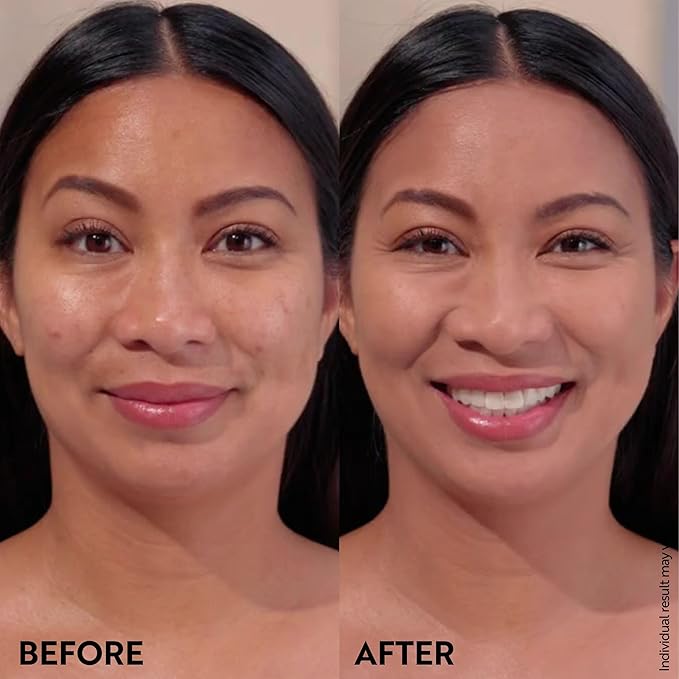 M. Asam Magic Finish Summer Teint Make-Up Mousse (1.01 Fl Oz) – 4in1 Primer, Foundation, Concealer & Powder With Buildable Coverage, Hides Redness And Dark Spots, Vegan, For Medium To Deep Skin Tones