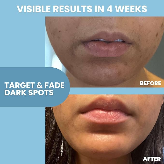 Eva Naturals Niacinamide Serum for Face with Zinc PCA & Botanical Hyaluronic Acid – Pore Minimizer, Dark Spot & Redness Relief, Skin Tone & Texture Support – Lightweight Cream Alternative (1 oz)