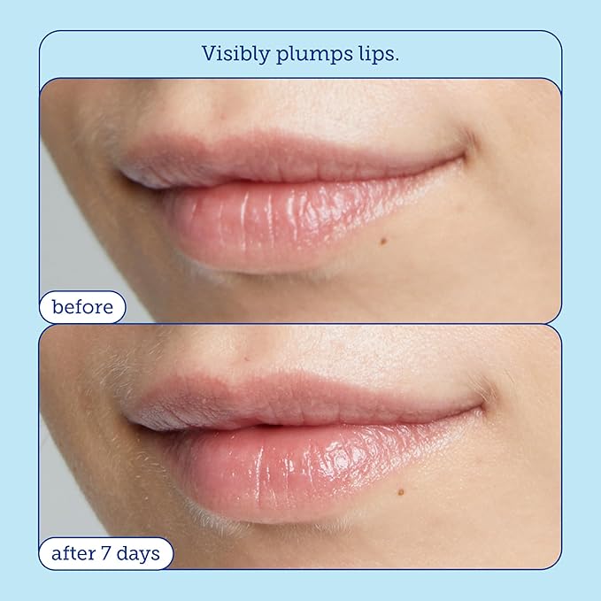 Skinfix Triple Lipid Lip Treatment - 0.27 oz - Hydrating, Volumizing Balm - Visibly Smooths Fine Lines - Fragrance Free - Vegan, Cruelty Free