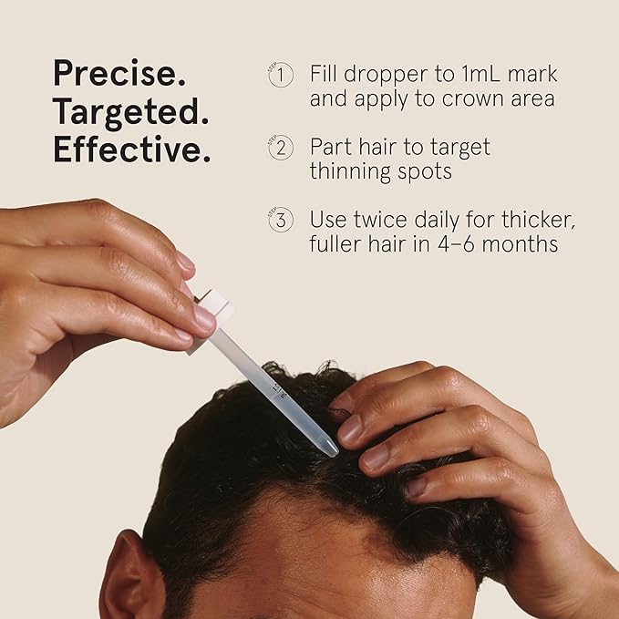 Keeps Extra Strength Minoxidil for Men Topical Hair Growth Serum, 5% Solution Hair Loss Treatment - 3 Month Supply (3 x 2oz Bottles with Dropper) - Slows Hair Loss & Promotes Thicker Hair Regrowth