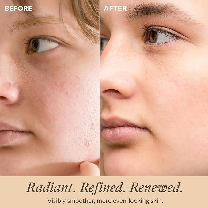 Bio Retinol Alternative Bakuchiol Serum - Smooths Skin & Reduces Fine Lines, USA Made with Natural & Organic Ingredients, Anti-Aging Skin Care Formula, Vegan, Cruelty Free