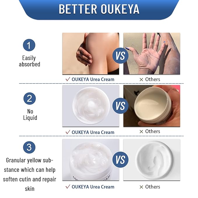 OUKEYA Urea Cream 40 Percent,Foot & Hand Cream for Dry Cracked,Urea Lotion for Feet Maximum Strength(2 Packs)