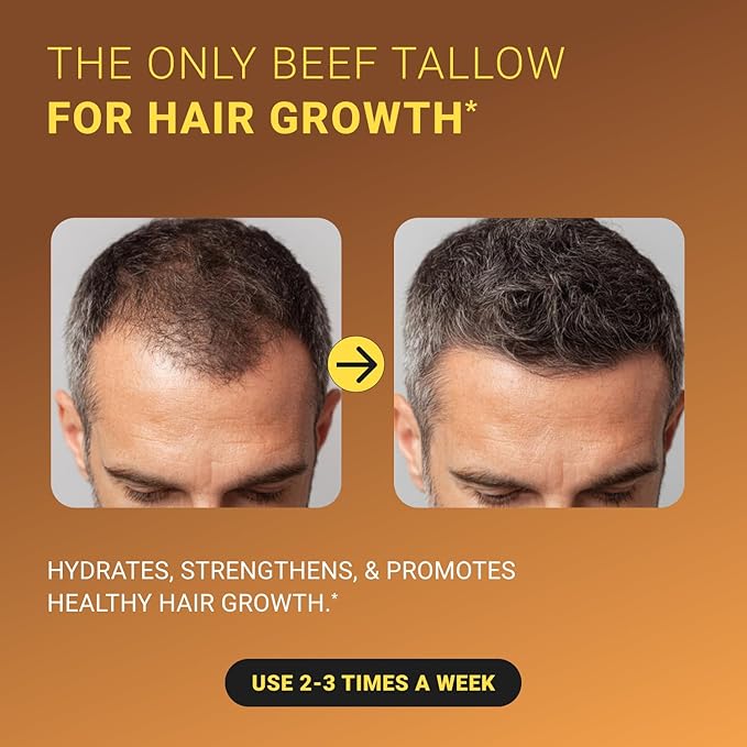 Non-Greasy Beef Tallow for Skin 5OZ Shea Butter, Vitamin E, Niacinamide, Whipped Grass Fed Beef Tallow for Face Moisturizer Cream, Body, Hair, Lotion for Women & Men, Anti-Aging Face Moisturizer