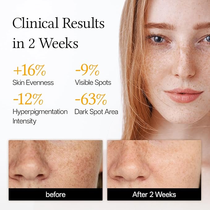 WNP Vitamin C Serum for Face - Dermatologist Tested Anti-Aging & Brightening with Hyaluronic Acid & Vitamin E, Treatment for Dark, Age, Sun Spot, Melasma, Hyperpigmentation, Fine Lines & Wrinkles