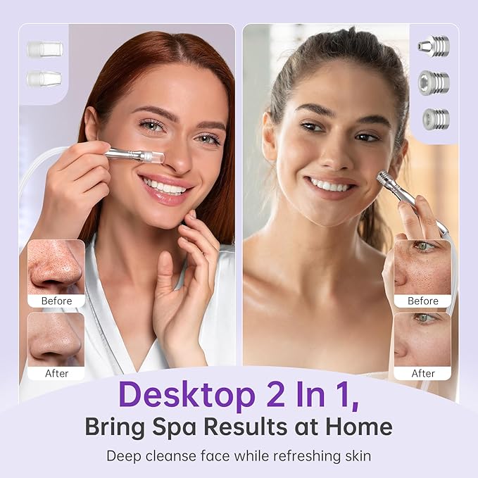 Blackhead Vacuum Removers, 2 in 1 Pro-Grade at-Home Spa Facial Vacuum Pore Cleaner for Blackheads, Whiteheads, Exfoliation, 20-80 Kpa Adjustable Suction for All Skin Types, White