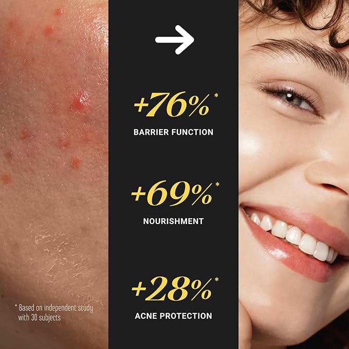 Non-Greasy Beef Tallow for Skin 5OZ Shea Butter, Vitamin E, Niacinamide, Whipped Grass Fed Beef Tallow for Face Moisturizer Cream, Body, Hair, Lotion for Women & Men, Anti-Aging Face Moisturizer