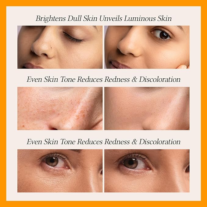 WNP Vitamin C Serum for Face - Dermatologist Tested Anti-Aging & Brightening with Hyaluronic Acid & Vitamin E, Treatment for Dark, Age, Sun Spot, Melasma, Hyperpigmentation, Fine Lines & Wrinkles