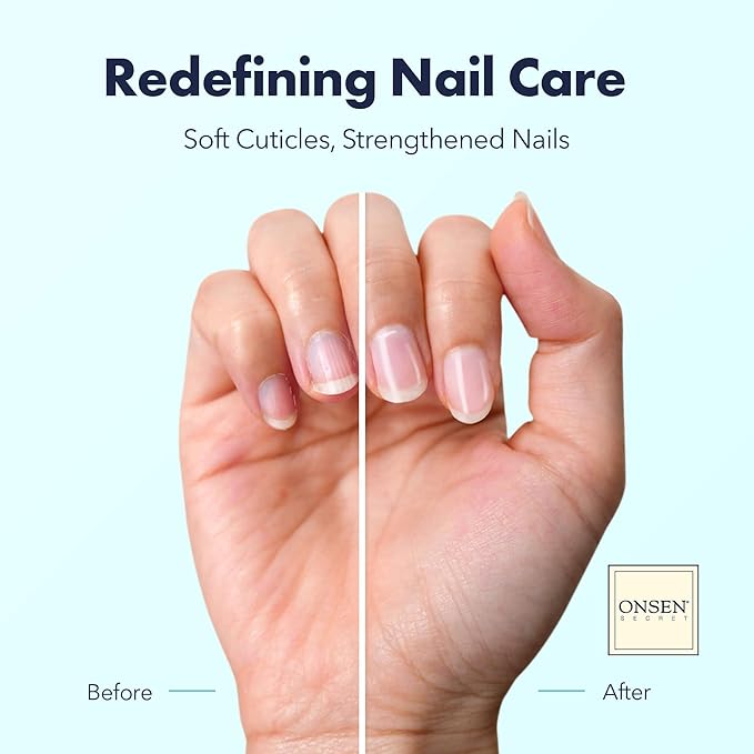 Onsen Secret Nail & Cuticle Repair Oil (2x30ml) - Dry Oil Formula - Japanese Tsubaki, Tea Tree & Jojoba - Strengthens Nails, Repairs Cuticles, Hydrates Skin & Hair - Natural & Vegan