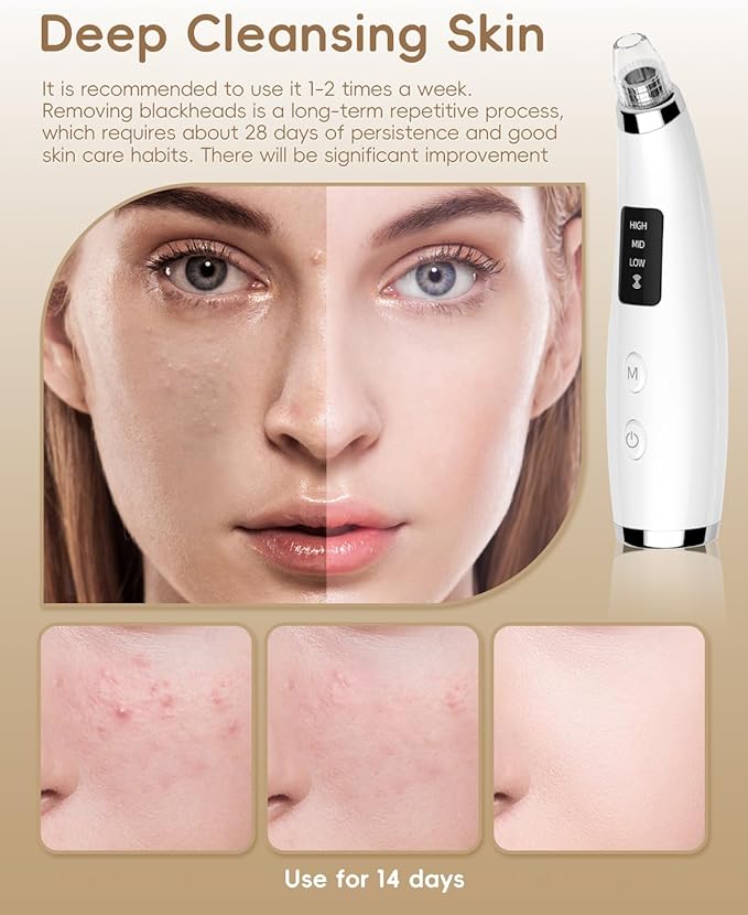 Facial Pore Blackhead Remover Vacuum - Fore Cleaner and Blackhead Extractor with 3 Adjustable Suction Levels - 5 Probes - Pore Vacuum Kit for Women&Men (White)