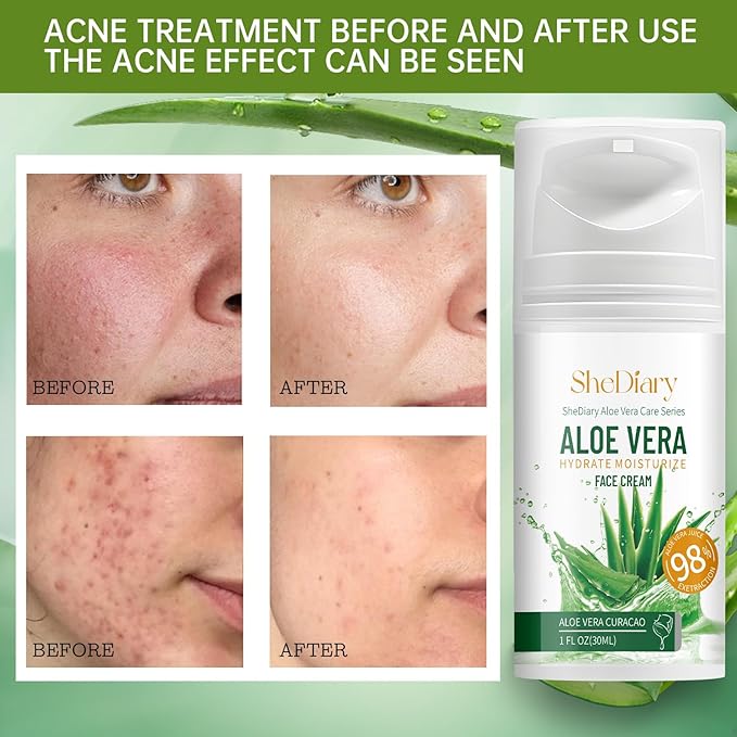 SheDiary Natural Aloe Vera Face Cream for Acne-Prone Skin - Plant-Based Formula to Hydrate, Firm, and Brighten Dull & Aging Skin 30ml