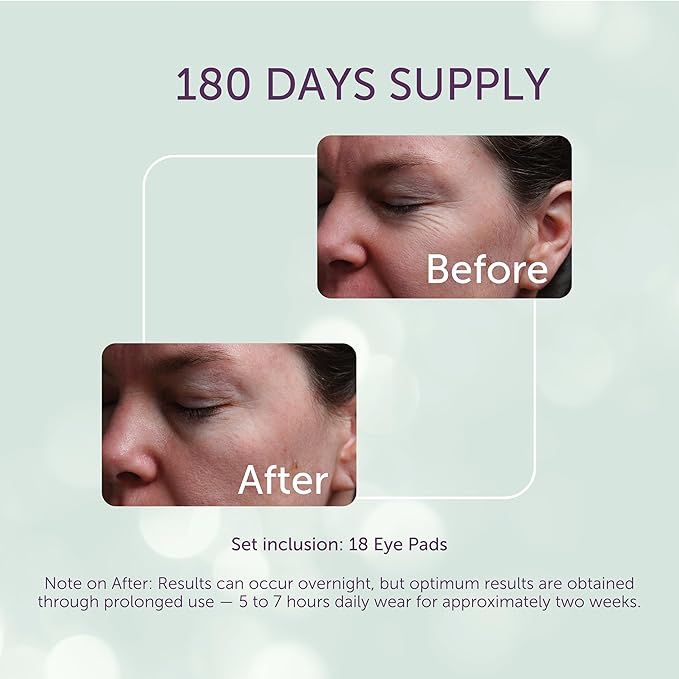 SilcSkin Silicone Eye Pads - Reusable Overnight Eye Patches, Medical-grade Silicone for Fine Lines, Crepey Skin, and Puffiness - 180 Day Supply
