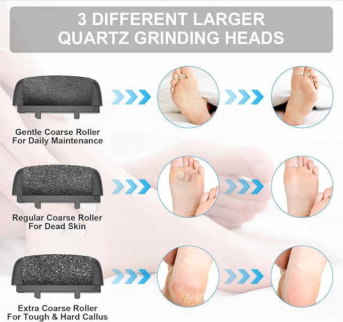 Callus Removers 8 Pack Replacement Rollers Heads for Electric Feet File Pedicure Tools, Pedicure Kit Refill Rollers 3 Extra Coarse, 3 Regular Coarse, 2 Fine Coarse Refill Rollers
