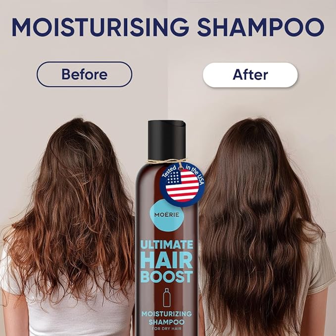 Moerie Ultimate Hair Growth Shampoo – For Longer, Thicker, Fuller Hair - Vegan Friendly Volumizing Hair Products – Paraben & Silicone Free – All Hair Types – Reverse Hair Loss