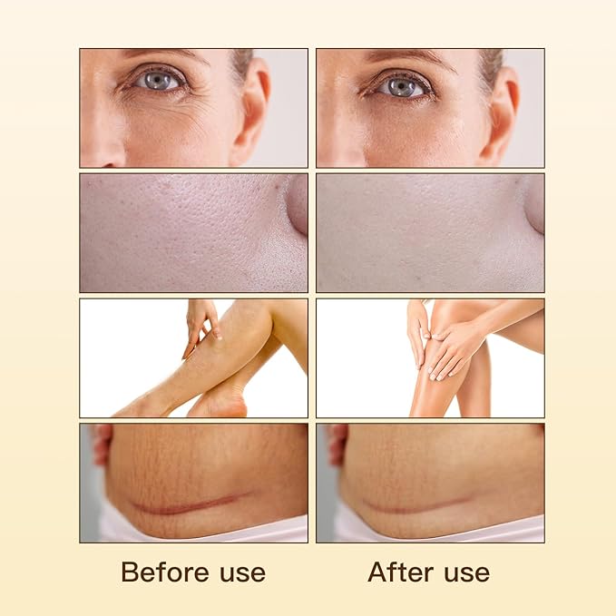 UWPU-80,000 IU Vitamin E Oil Natural Extraction of Bakuchiol, Wrinkles and Age Spots, Vitamin E Oil for Scars Enhancement of Skin Collagen Moisturized, for all Skin Types-30ml / 1 Oz
