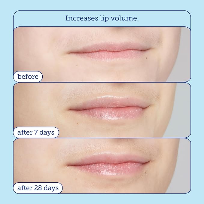 Skinfix Triple Lipid Lip Treatment - 0.27 oz - Hydrating, Volumizing Balm - Visibly Smooths Fine Lines - Fragrance Free - Vegan, Cruelty Free