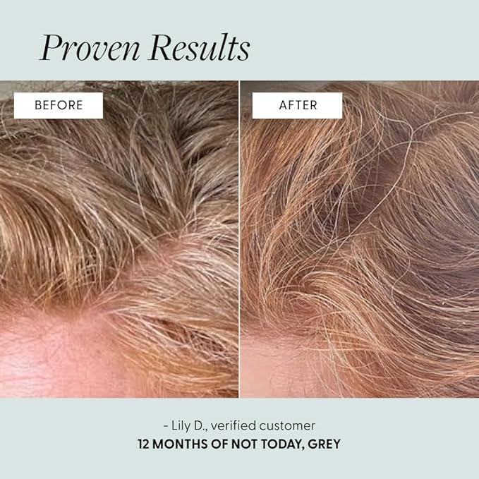 Arey Not Today, Grey Daily Hair Supplement for Women & Men | Slows Grey Hair Growth & Repigment in 3-6 Months | Promotes Healthier, Thicker Hair | Biotin, B +D Vitamins | Vegan & Gluten Free (1 Month)
