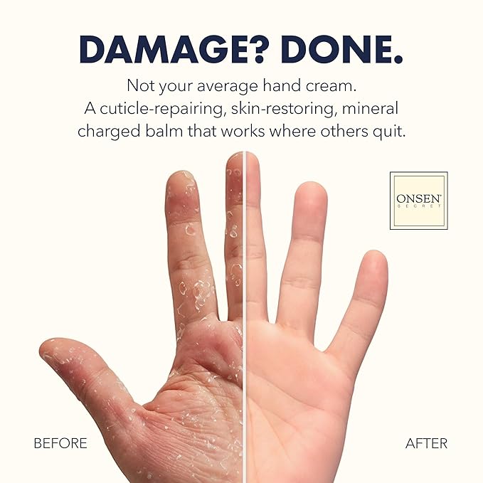 Onsen Hand & Cuticle Rescue Cream | Organic Nail Strengthener & Balm | Dry, Cracked Hands, Elbows & Feet | Shea Butter, Tsubaki & Jojoba Oil | Nail Repair & Growth, Vegan – 2 Pack (0.88 oz)
