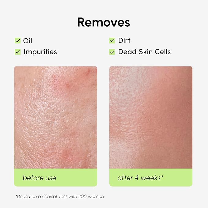 MAREE Exfoliating Toner with Salicylic Acid – AHA BHA Face Exfoliant & Pore Cleaner – BHA Liquid Exfoliant for Sebum & Dead Skin Care Remover – Face Exfoliator – Acido Salicilico Exfoliante Facial