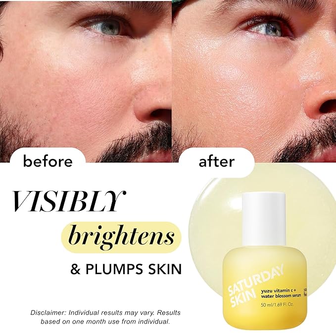 Vitamin C Serum For Face From Yuzu - Brightening Formula With Hyaluronic Acid 7 Peptide Mix And Niacinamide, Deeply Hydrate, Improve Uneven Skin Texture, Vegan, Korean Skin Care (30 ml)