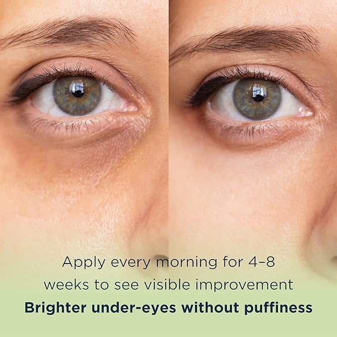 MATKAS Korean Vitamin C Caffeine Eye Cream for Dark Circles 0.5 Fl Oz - Dark Circles Under Eye Treatment, Eyes Cream Anti Aging for Puffy Eyes