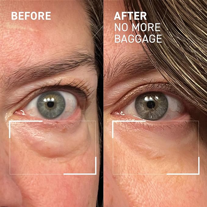 Dr. Brandt Needles No More, No More Baggage - Minimizes Under-Eye Bags, Puffiness & Dark Circles - 0.25 oz