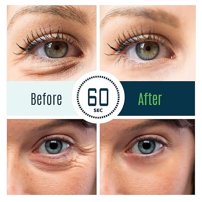 Puffy Eye Treatment Time Reverse Instant Anti-aging Eye Cream New Advanced Formula - Visibly Reduce Under-eye Bags, Wrinkles, Dark Circles, Fine Lines & Crow's Feet Instantly - 8ml