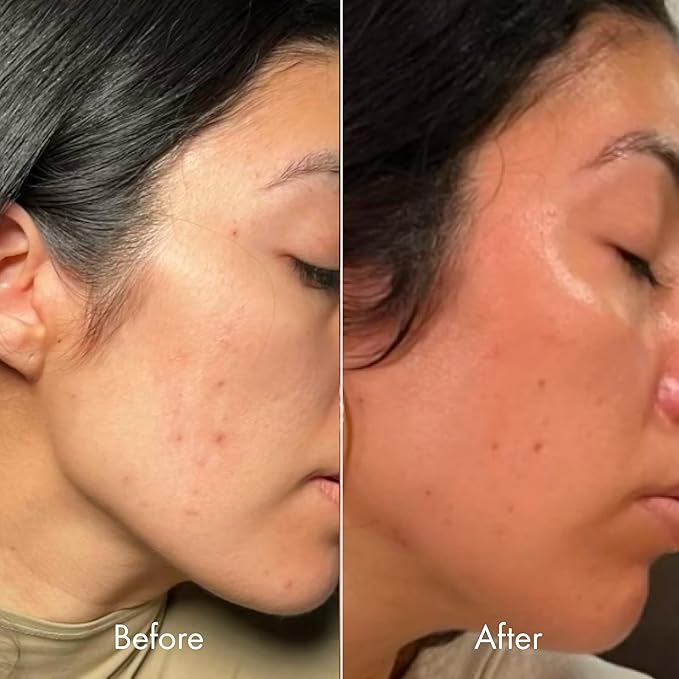 Kopari Moisture Whipped Ceramide Cream | Hydrate and Restore | Vegan Ceramides and Moisture-Retaining Hyaluronic Acid | 2.1 oz