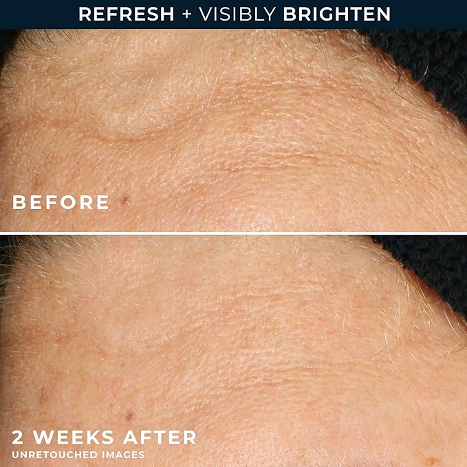 RoC Multi Correxion Revive + Glow Gel Vitamin C Cleanser, Face Wash, Facial Cleanser with Glycolic Acid, Paraben-Free, Sulfate-Free Skin Care - 6 Ounces